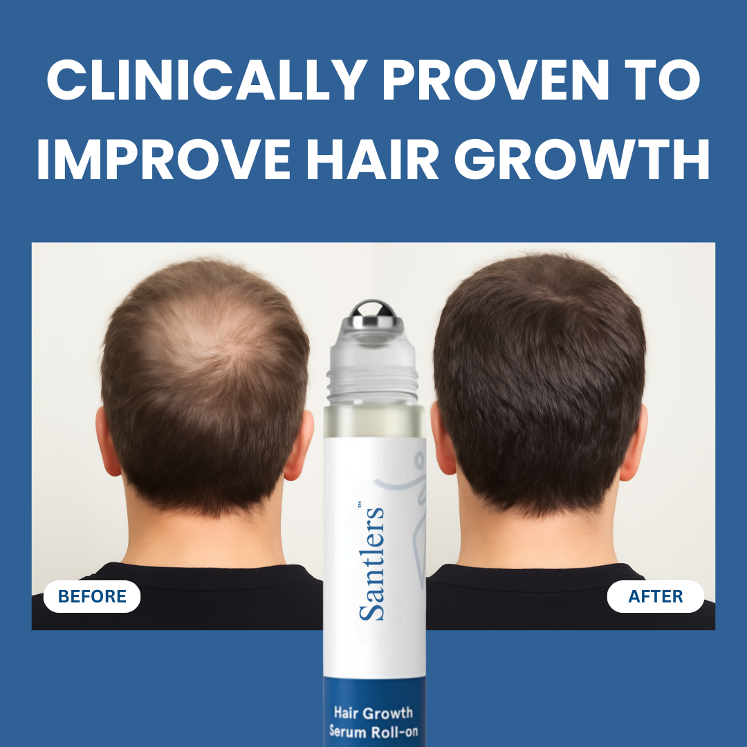Santlers™ Advanced Hair Growth Roll-On Serum