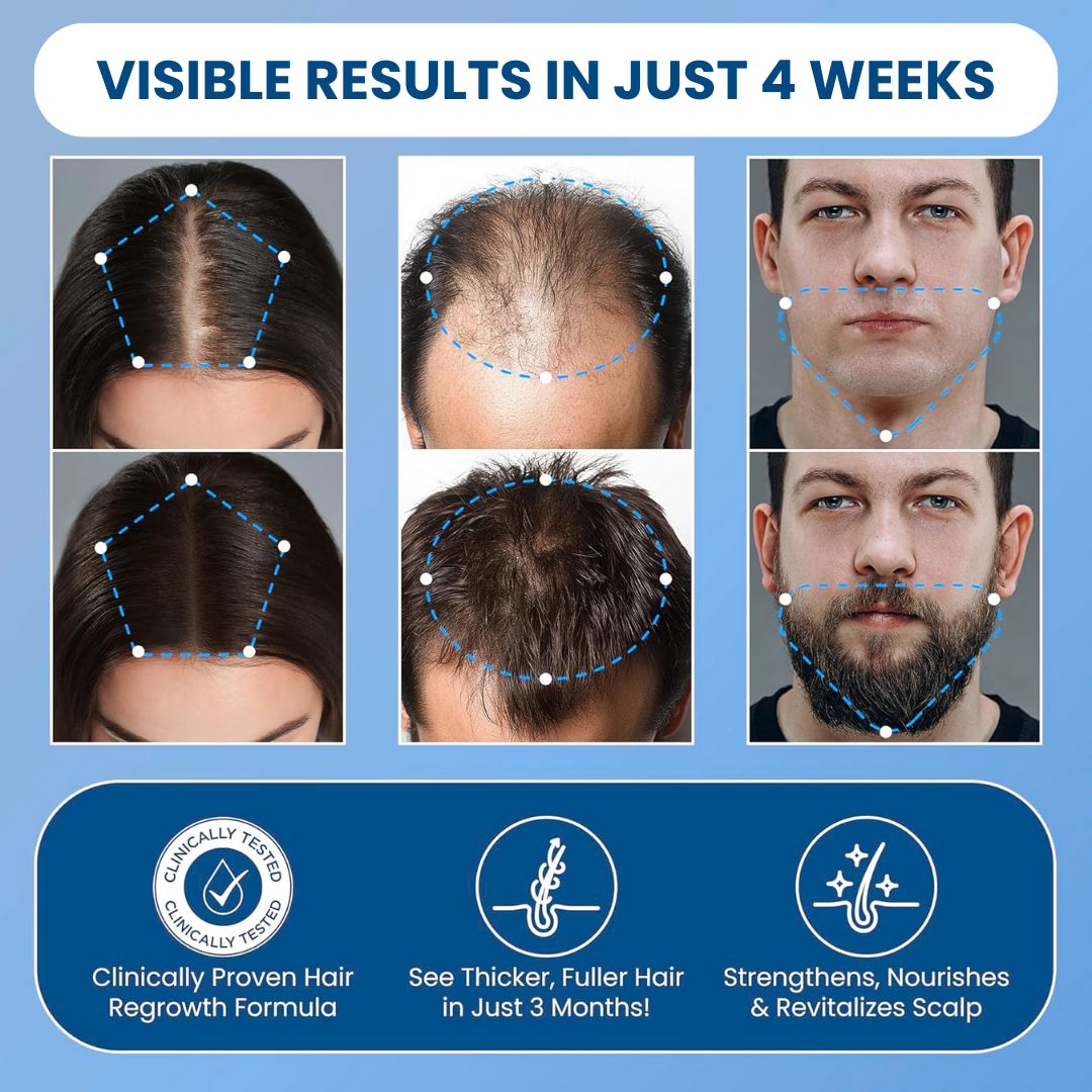 Santlers™ Advanced Hair Growth Roll-On Serum