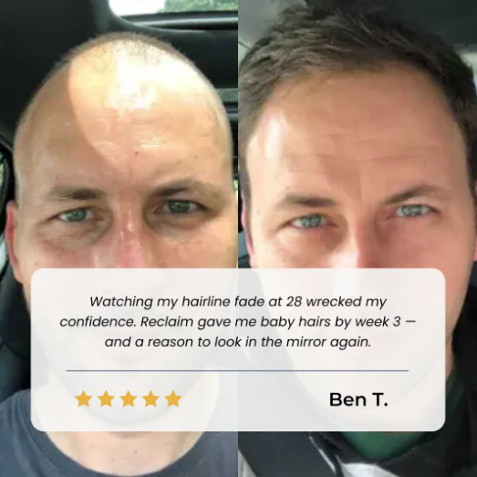 Santlers™ Advanced Hair Growth Roll-On Serum