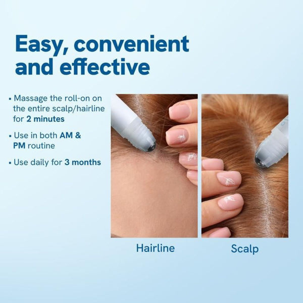 Santlers™ Advanced Hair Growth Roll-On Serum