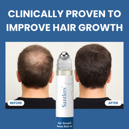 Santlers™ Advanced Hair Growth Roll-On Serum